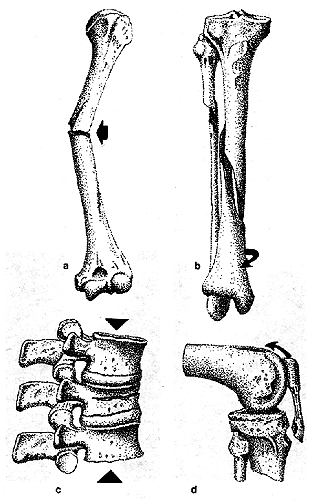 http://escuela.med.puc.cl/paginas/publicaciones/TextoTraumatologia/imagenes/028.gif