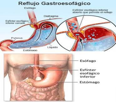 Cambios Fisiológicos Maternos Durante El Embarazo