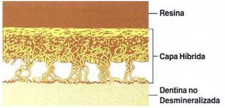 Adhesion en odontología estetica y restauradora página 2