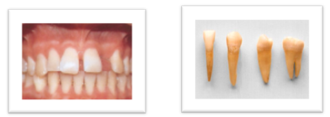 Odontología forense