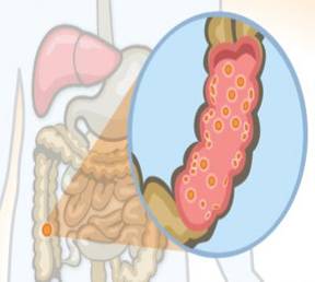 Flora Microbiana Intestinal Monografias Com