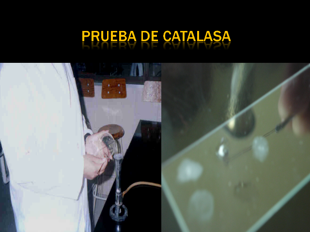 prueba de catalasa