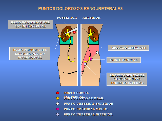 Resultado de imagen para Puntos renales