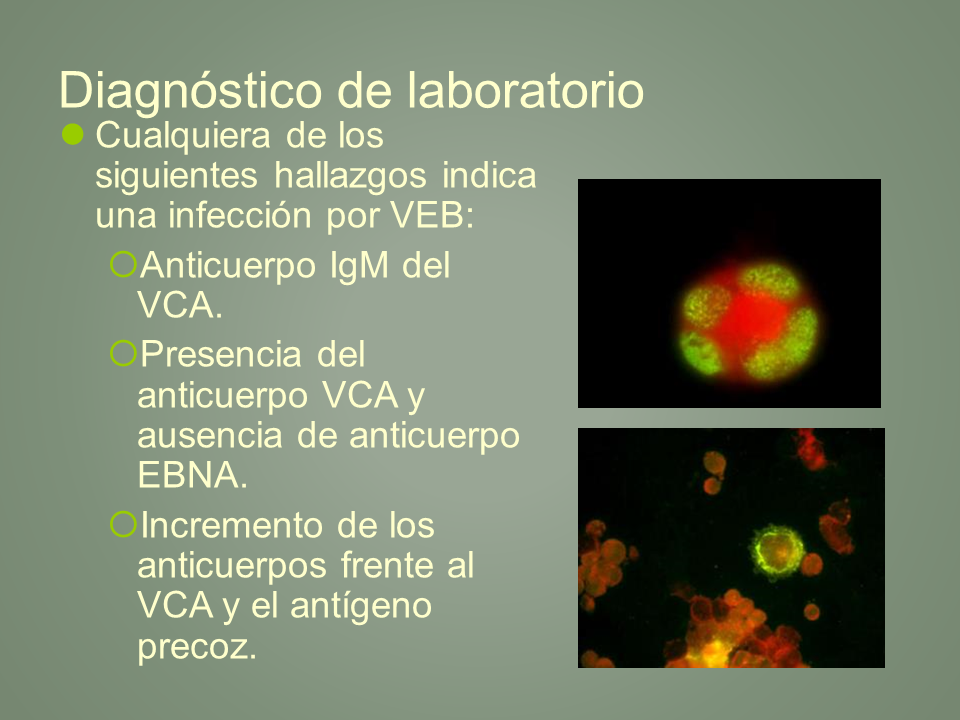 Virus de Epstein-Barr (página 3) - Monografias.com