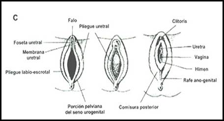 diagrama de genitales intersexuales