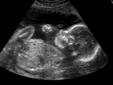 citas fetal por ultrasonido pdf