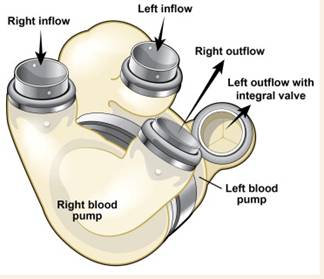 Resultado de imagen para caracterÃ­sticas del corazÃ³n artificial